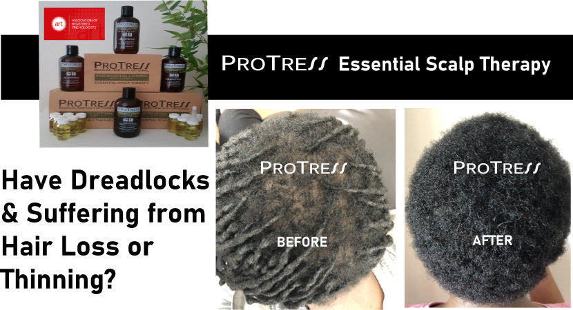 Have Dreadlocks and Suffering from Hair Loss or Thinning?