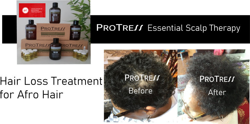 Hair Loss Treatment for Afro Hair